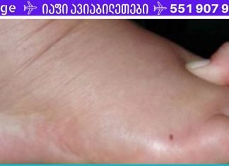 დაემშვიდობეთ სითხის დაგროვებას, შეშუპებასა და ჭარბ წონას ორგანიზმში! ამას დასჭირდება მხოლოდ 1 კვირა…