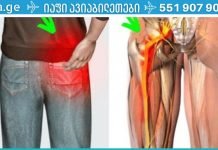 საჭდომის ნერვის ტკივილის დროს მიიღეთ ამ ნარევის ერთი კოვზი! ტკივილი უმოკლეს დროში მოგეხსნებათ!.