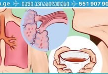 ეს წამალია, რომელიც ამოიღებს ნახველს ფილტვებიდან და დაგეხმარებათ ასთმის მოშორებაში!