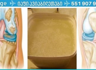 რას წარმოვიდგენდი, თუ ეს საშუალება დამეხმარებოდა სახსების ტკივილის მოცილებაში!!.. ტკივილი სულ რაღაც ერთ კვირაში გამიქრო..