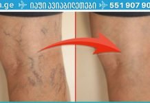 ჩემს მეგობარს აწუხებდა ვარიკოზული ვენები. მან ეს მალამო წაისვა და შედეგით გაოცებული დარჩა! თუ ეს პრობლემა თქვენც გაწუხებთ, გირჩევთ გამოიყენოთ..