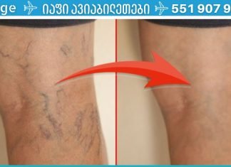 ჩემს მეგობარს აწუხებდა ვარიკოზული ვენები. მან ეს მალამო წაისვა და შედეგით გაოცებული დარჩა! თუ ეს პრობლემა თქვენც გაწუხებთ, გირჩევთ გამოიყენოთ..