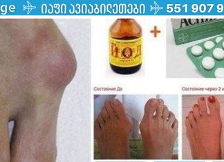 ასპირინისა და იოდის ნარევი მოგიხსნით პოდაგრას! ეს უნდა სცადოთ..