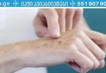 8 ეფექტური გზა ასაკობრივი ლაქების მოსაშორებლად! არასოდეს ყოფილა ასე ადვილი პრობლემასთან გამკლავება!