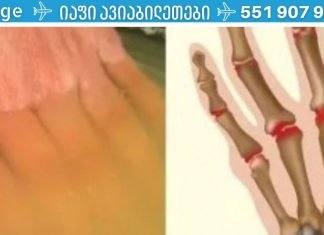 უბრალოდ მოათავსეთ მტკივნეული ხელები ძმარში დამოიცილეთ აუტანელი ტკივილი!ის ნამდვილად მუშაობს! სულ დამავიწყდა ტკივილი!