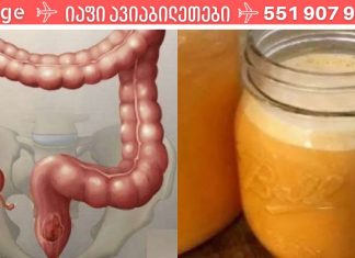 დაავადებების 90% გამოწვეულია მსხვილი ნაწლავის ტოქსინებით. აი, როგორ გავწმინდოთ იგი ერთხელ და სამუდამოდ! მნიშვნელოვანია იცოდეთ!!.