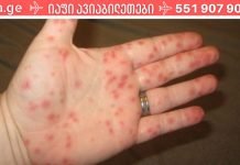 ყურადღება – ახალი ვირუსის ეპიდემია! ყველა მშობელმა უნდა იცოდეს ეს სიმპტომები.