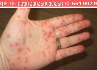 ყურადღება – ახალი ვირუსის ეპიდემია! ყველა მშობელმა უნდა იცოდეს ეს სიმპტომები.