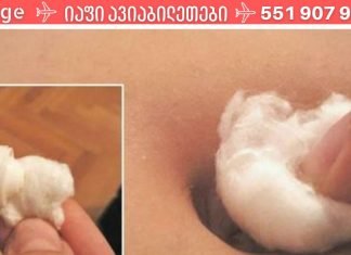 მოიცილეთ ხველა და გაციება ძალიან მარტივად! ამისათვის რაც თქვენ უნდა გააკეთოთ არის ჭიპში ალკოჰოლით გაჟღენთილი ბამბის დამაგრება..!