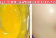 დედაჩემი კვლავ ახალგაზრდად გამოიყურება ამ შესანიშნავი რეცეპტის გამოყენებით! აი როგორ უნდა შეზეთოთ…