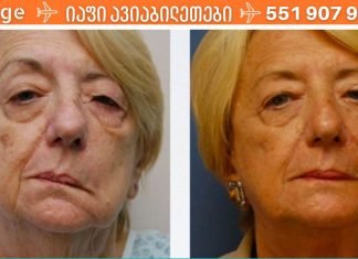 ინსულტის 7 ადრეული ნიშანი, რომლის შესახებ ყველამ უნდა იცოდეს! აუცილებლად წაიკითხეთ და გაგვიზიარეთ თქვენი ცოდნა! ეს ძალიან მნიშვნელოვანია!