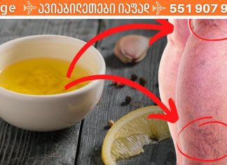 უმკურნალეთ ვარიკოზულ ვენებს ნიორით! ამაზე ეფექტური არაფერი მინახავს..