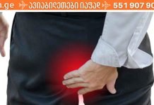 როგორ ავიცილოთ თავიდან ბუასილი? უმკურნალეთ ბუასილს სახლის პიობებში..