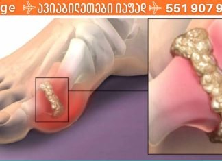 როგორ შლის შარდმჟავას ორგანიზმიდან ეს მარტივი წვენის რეცეპტი? ყველას აქვს ეს ინგრედიენტები!