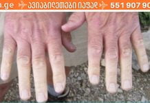 თუ ხშირად ხელები და ფეხები ცივი გაწვთ, გაითვალისწინეთ ეს რჩევები! ისინი დაგეხმარებათ ამ პრობლემის მოგვარებაში..