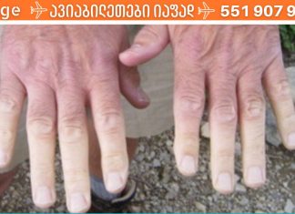 თუ ხშირად ხელები და ფეხები ცივი გაწვთ, გაითვალისწინეთ ეს რჩევები! ისინი დაგეხმარებათ ამ პრობლემის მოგვარებაში..