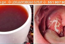 ყელის ტკივილის ბუნებრივი საშუალება: მხოლოდ 4 საათი – და ყელის ტკივილის სიმპტომები გაქრება!