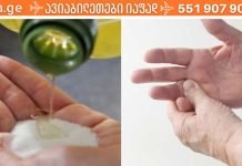 საცხობი სოდა და აბუსალათინის ზეთი: ეს კომბინაცია ცნობილი მკურნალია. დაეხმარეთ სხეულს განკურნებაში!