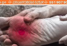 თუ ფეხების წვის შეგრძნება არ გასვენებთ და ამის მიზეზი ვერ დაადგინეთ, მაშინ ეს სტატია უნდა წაიკითხოთ!