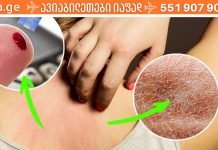 7 ნიშანი იმისა, რომ ძალიან ბევრ შაქარს მიირთმევთ. ეს უნდა გაითვალისწინოთ!.