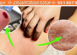 7 ნიშანი იმისა, რომ ძალიან ბევრ შაქარს მიირთმევთ. ეს უნდა გაითვალისწინოთ!.