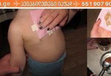 დედამ ეს კომპრესა ბავშვს ღამით გაუკეთა. რაც დღეს დილით მოხდა, საოცარია!