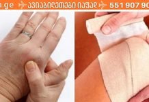 თუ სახსრები გაწუხებს ღამით დაიდე ეს კომპრესი და დილით ტკივილის არსებობა აღარ გმახსოვრება..