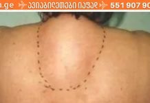 ვისაც კისერზე მარილები აქვს, ეს რეცეპტი გამოადგება.. საოცარია..