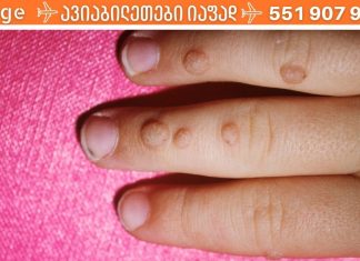 გამოიყენე წყალბადის ზეჟანგი და ერთხელ და სამუდამოდ მოიშორე მეჭეჭები და პაპილომები! ამაზე ეფექტური არაფერი არსებობს..