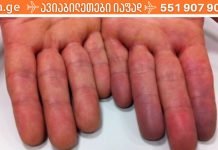 როგორ გავაუმჯობესოთ გულის მუშაობა? ეს აუცილებლად უნდა იცოდეთ!!.