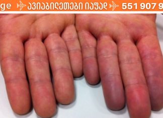 როგორ გავაუმჯობესოთ გულის მუშაობა? ეს აუცილებლად უნდა იცოდეთ!!.