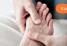 3 წელი მტანჯავდა ფეხის დიდ თითზე ძვლოვანი წანაზარდი.. ერთხელ ჩემმა მეზობელმა მირჩია ხალხური მეთოდი, მისი გამოყენების შემდეგ მალევე სულ დამავიწყდა პოდაგრას არსებობა..