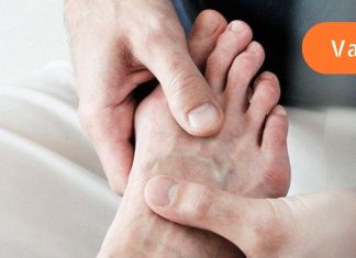 3 წელი მტანჯავდა ფეხის დიდ თითზე ძვლოვანი წანაზარდი.. ერთხელ ჩემმა მეზობელმა მირჩია ხალხური მეთოდი, მისი გამოყენების შემდეგ მალევე სულ დამავიწყდა პოდაგრას არსებობა..