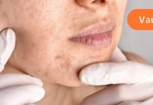 გაფართოებული ფორები სახეზე: როგორ გავაუმჯობესოთ პრობლემური კანის მდგომარეობა?