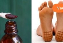 რატომ არის ძალიან სასარგებლო ღამით ქუსლებზე იოდის წასმა?