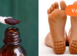 რატომ არის ძალიან სასარგებლო ღამით ქუსლებზე იოდის წასმა?