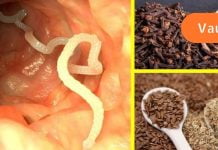 გამოიყენეთ სელის თესლი და მიხაკი ორგანიზმიდან პარაზიტების გამოსადევნად.. ამაზე ეფექტური საშუალება არ არსებობს!