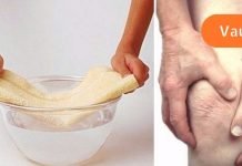 ეს არის განსაკუთრებული შემთხვევა, როდესაც ტრადიციულმა მედიცინამ გადაარჩინა ხანდაზმული ქალი, რომელიც განიცდიდა სახსრების აუტანელ ტკივილს და განკურნების იმედი აღარ ჰქონდა.