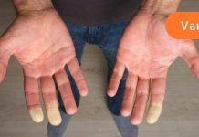 როგორ გავაუმჯობესოთ სისხლის მიმოქცევა წამლების გარეშე