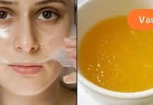 გამოიყენეთ რძის და ჟელატინის ნიღაბი შავი წერტილების მოსაშორებლად