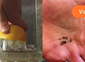 თუ თირკმლებში კენჭები გაქვს, სცადე ოხრახუშისა და ლიმონის ნაყენი მის დასაშლელად!.. ძალიან ეფექტურია..