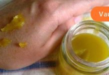 პროპოლისისა და ვაზელინის ნარევი ეხმარება ბუასილის, ყურის ტკივილისა და სხვა მრავალი დაავადების სწაფად განკურნებას!