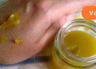 პროპოლისისა და ვაზელინის ნარევი ეხმარება ბუასილის, ყურის ტკივილისა და სხვა მრავალი დაავადების სწაფად განკურნებას!