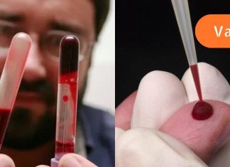 სისხლის გამათხელებლები: შეაჩერეთ შინაგანი ორგანოების შიმშილი და თრომბოზი! ეს აუცილებლად უნდა იცოდეთ!