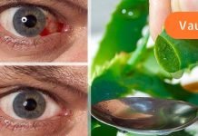 თუ მხედველობის პრობლემა გაქვთ, მინდა გასწავლოთ ხალხური რეცეპტი, რომელიც დაგეხმარებათ მხედველობის გაუმჯობესებაში!