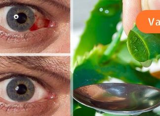 თუ მხედველობის პრობლემა გაქვთ, მინდა გასწავლოთ ხალხური რეცეპტი, რომელიც დაგეხმარებათ მხედველობის გაუმჯობესებაში!