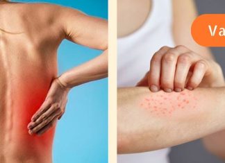 ეს სიმპტომები თირკმლების არასწორ მუშაობაზე მიუთითებს.. იმოქმედეთ სანამ ძალიან გვიან არ არის!