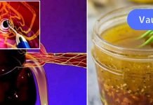 ეს ბუნებრივი საშუალებაა ქოლესტერინისა და მაღალი წნევის წინააღმდეგ! რეცეპტი, რომელიც ბევრს გამოადგება..