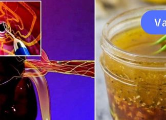 ეს ბუნებრივი საშუალებაა ქოლესტერინისა და მაღალი წნევის წინააღმდეგ! რეცეპტი, რომელიც ბევრს გამოადგება..