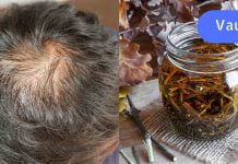 ბებიამ მირჩია თმის დაბანა მუხის ქერქით. ამის შემდეგ თმა გაცოცხლდა და აღარ მცვივა